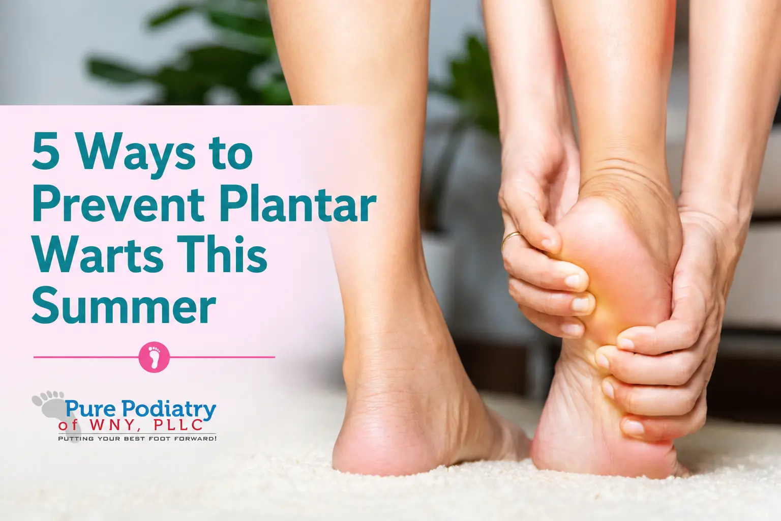 5 Simple Ways to Prevent Plantar Warts This Summer