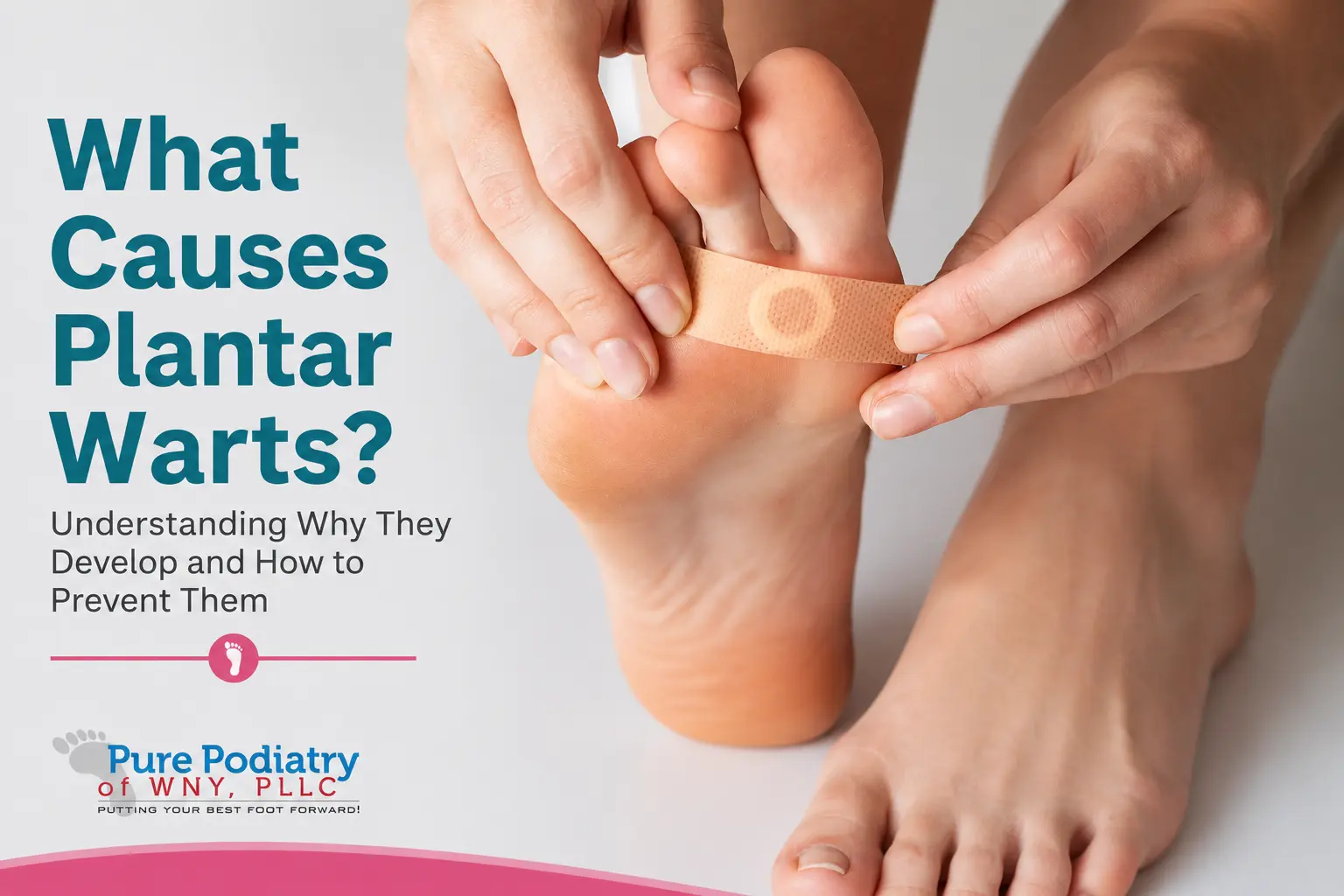 What Causes Plantar Warts